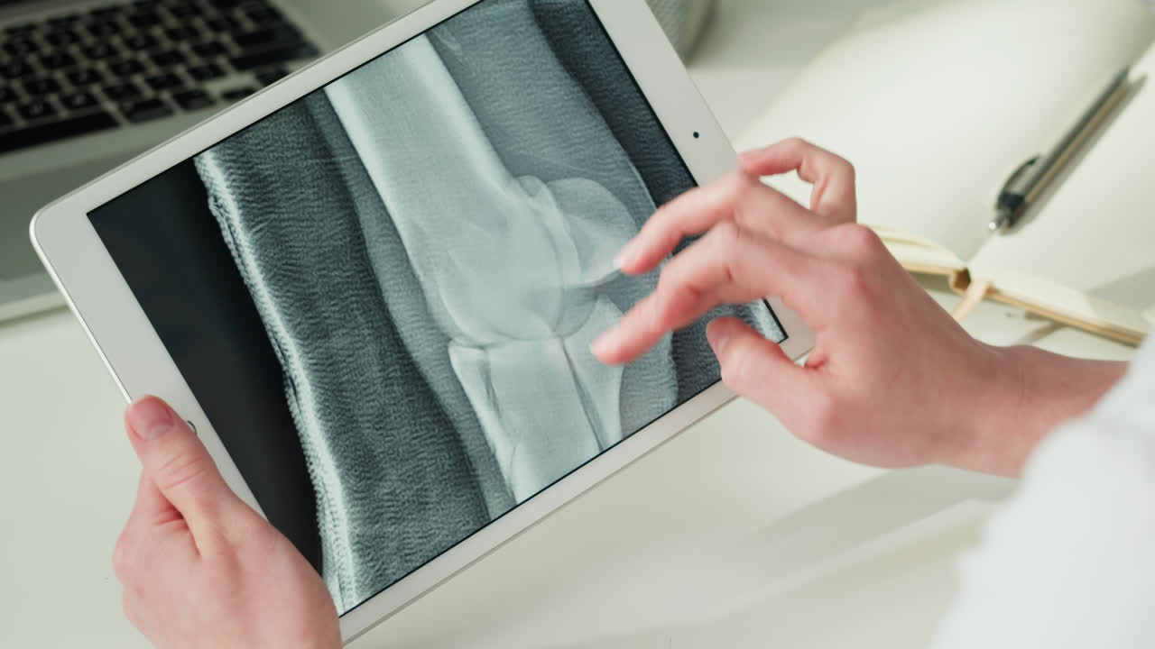 X-ray Examination on Tablet
