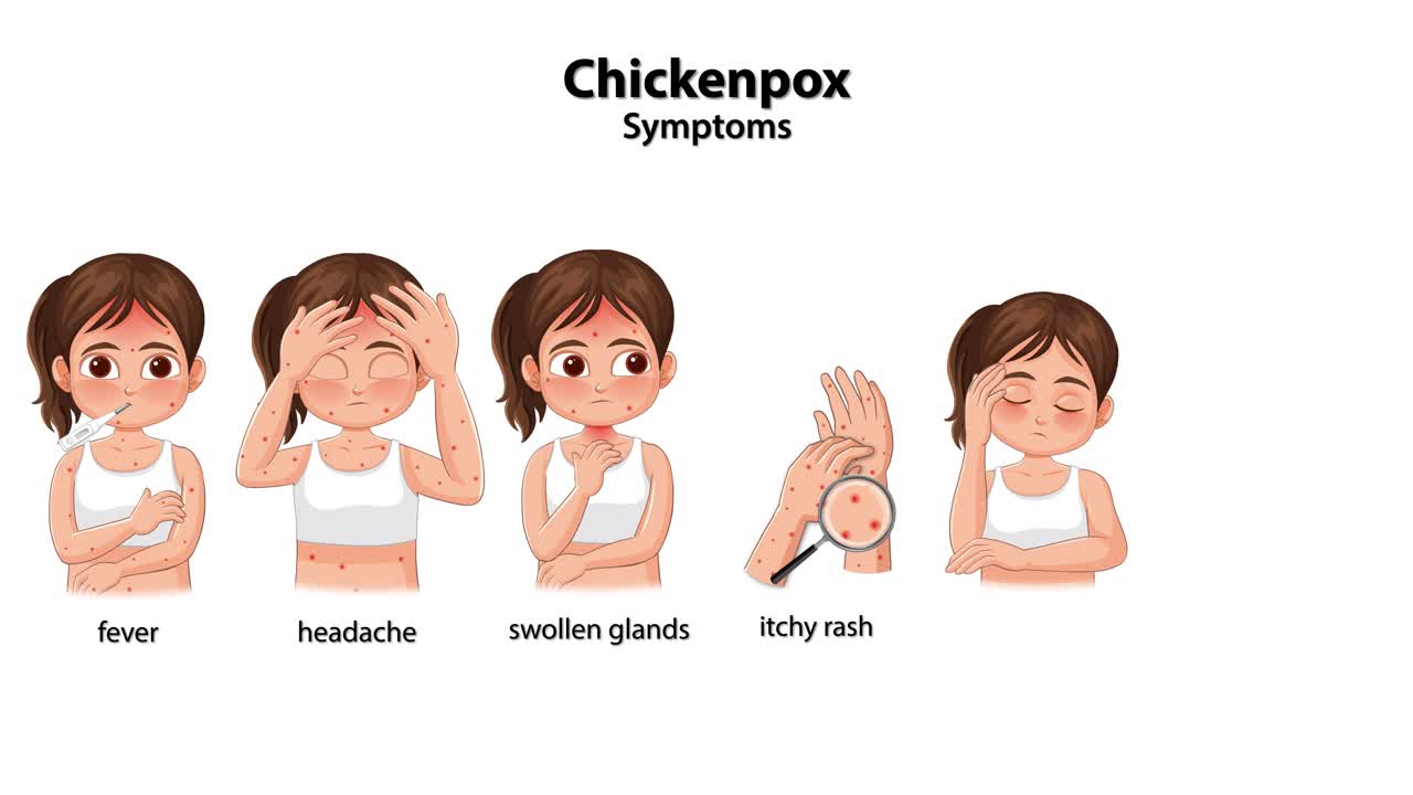 Animated sequence illustrating chickenpox symptoms in a young girl with clear, labeled visuals