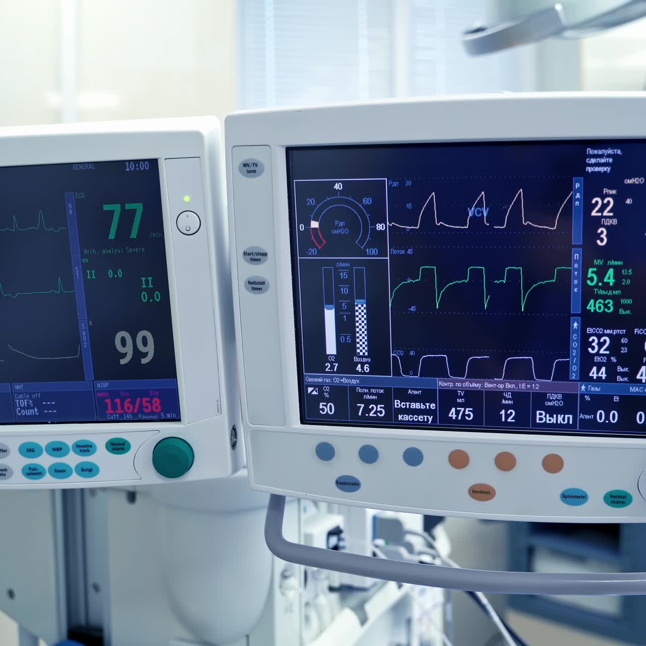 Medical monitors in the intensive care unit. Graphic lines on the screen of monitors showing heart ecg of patient's condition during the operation.