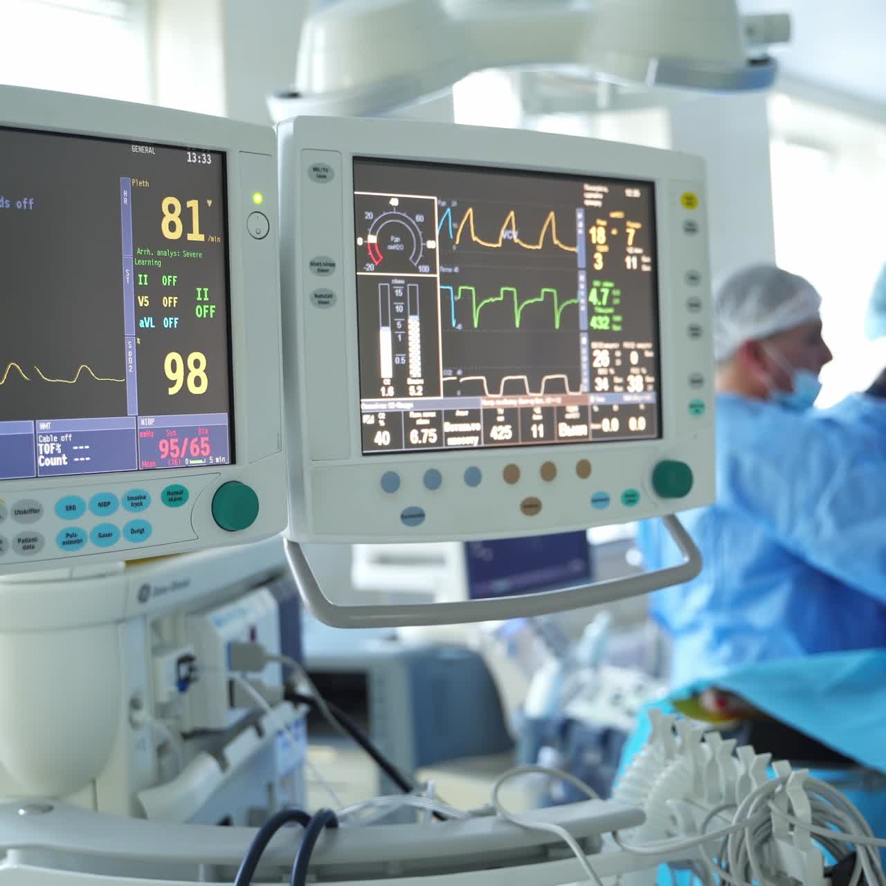Monitor di moderne attrezzature mediche. Equipe di chirurghi che esegue un intervento in sala operatoria.