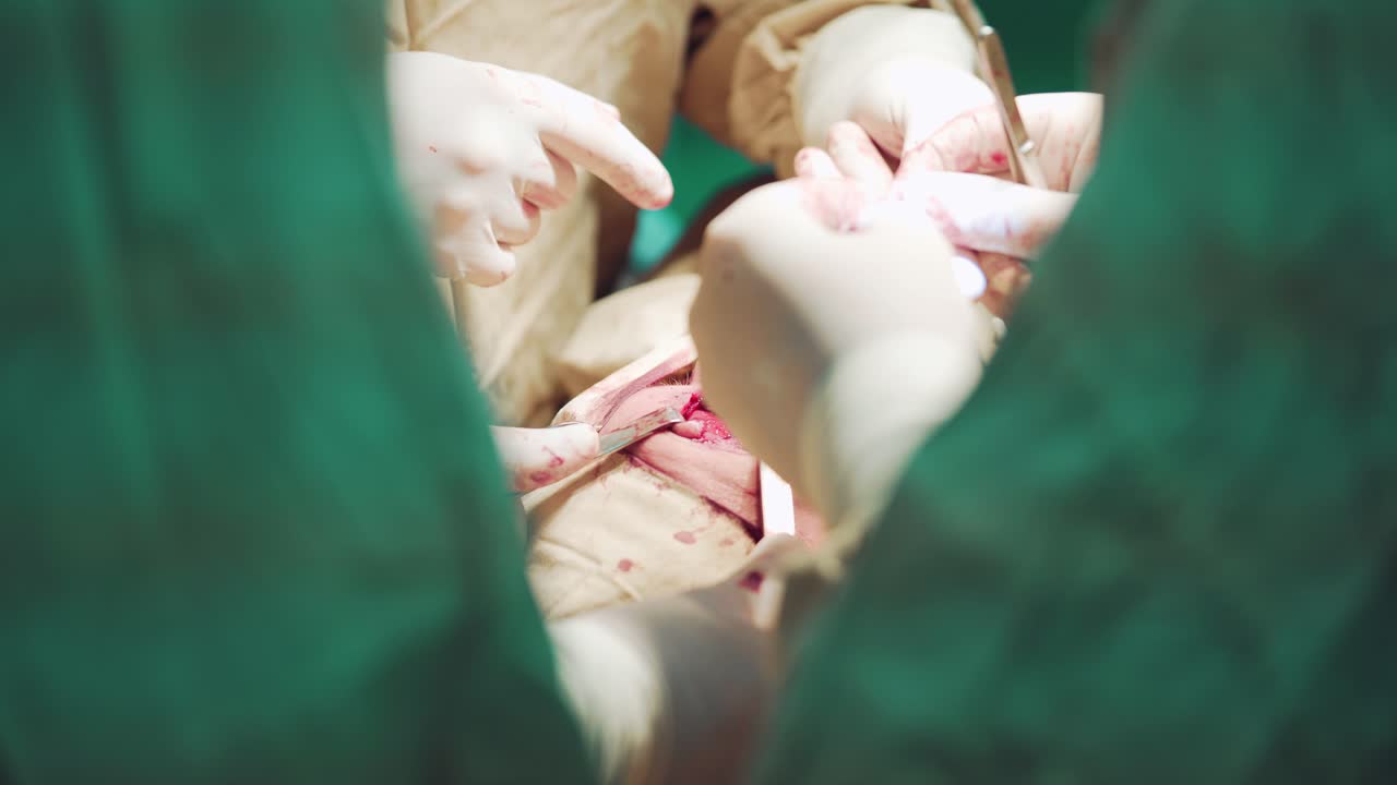 Surgeons perform surgery on a face of patient in gloves in the operating room in the hospital. Working with surgical instruments. Close-up