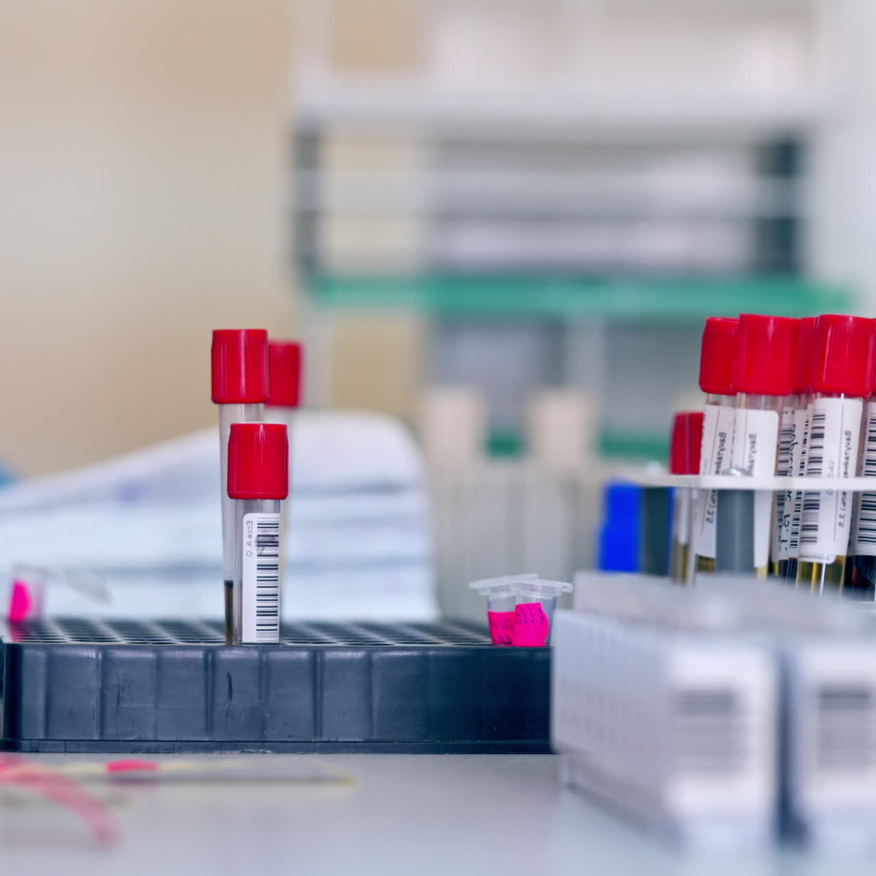 Blood samples on the table. Laboratory assistant working with vials in clinic. Test tubes with liquid on plastic supports. Close-up.