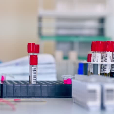 blood samples on the table. laboratory assistant working with vials in clinic. test tubes with liquid on plastic supports. close-up.