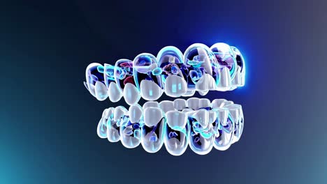 3d model of teeth and dentures