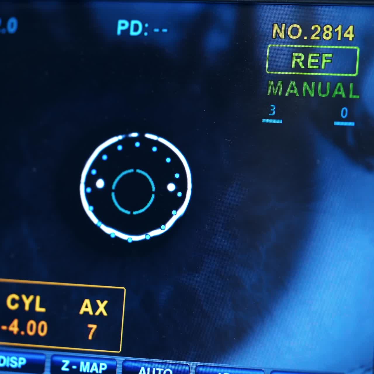 Eye operation monitor