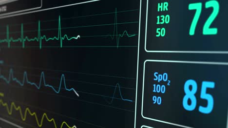 ecg cardio heart beat monitor in hospital loop and seamless