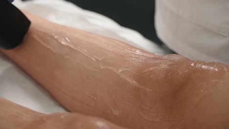 close-up of laser hair removal on a woman's calf, with gel applied by a gloved technician