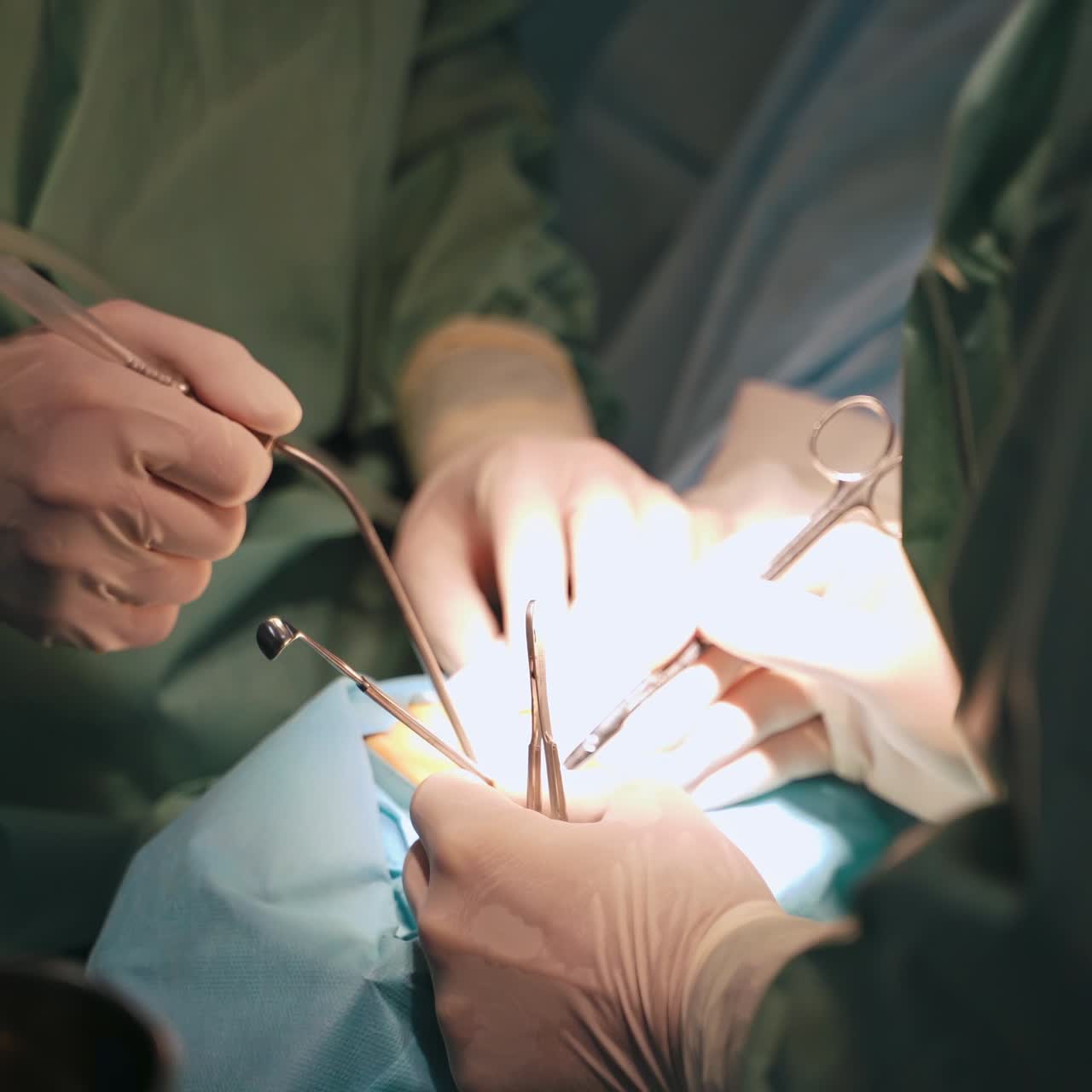 Group of surgeons in operation room