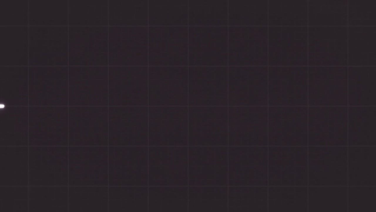 심전도 (ecg) 추적