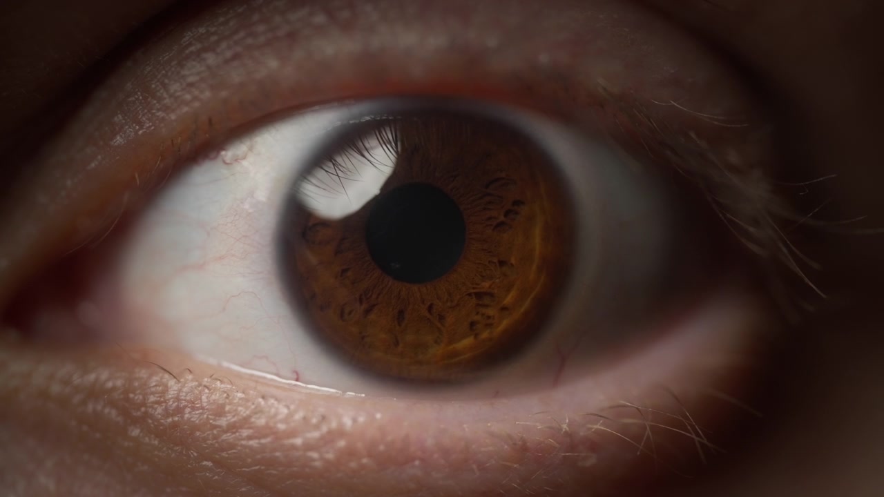 Brown eye opening widely