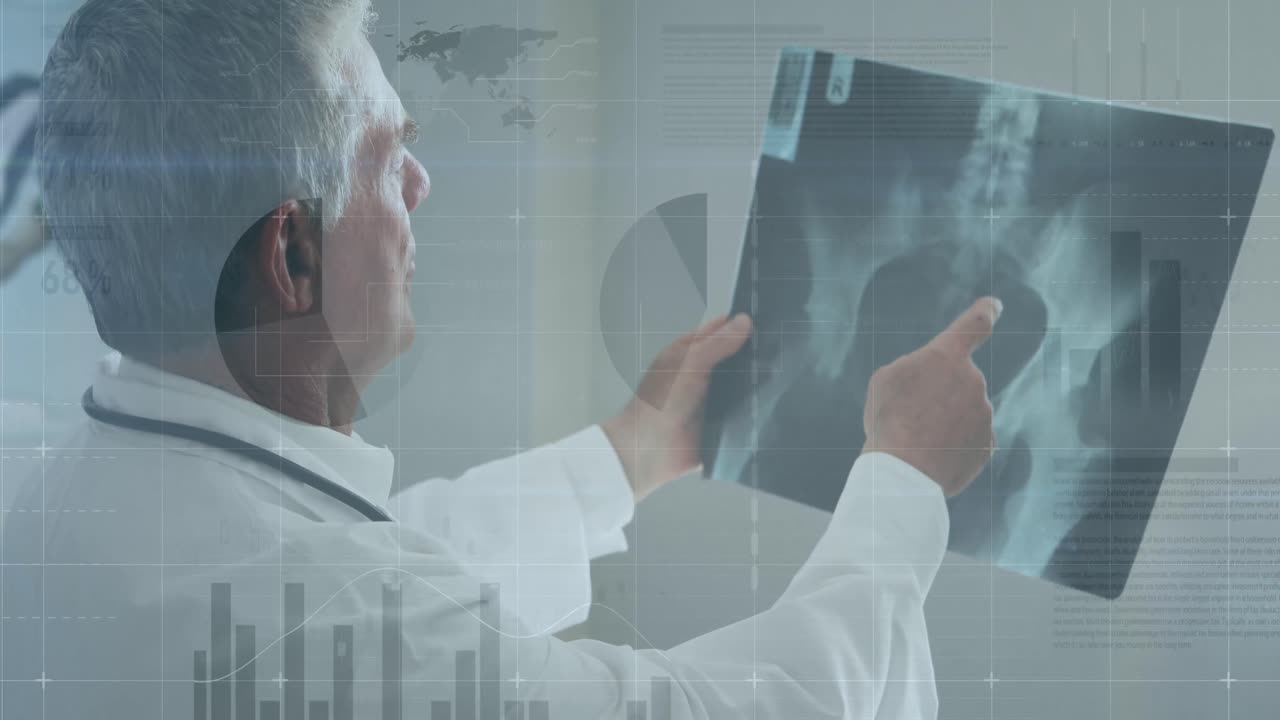 카우카시안 의사에 대한 금융 데이터 처리 애니메이션