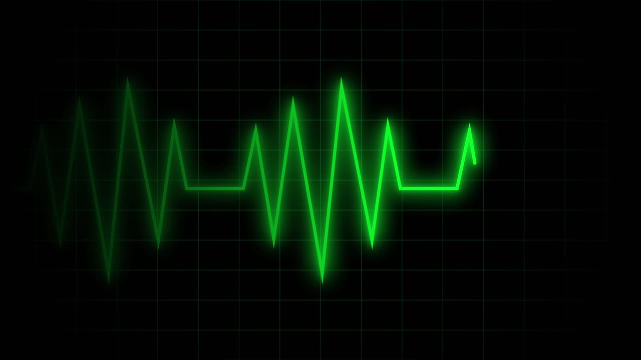 Linea verde del battito cardiaco su schermo monitor ECG nero