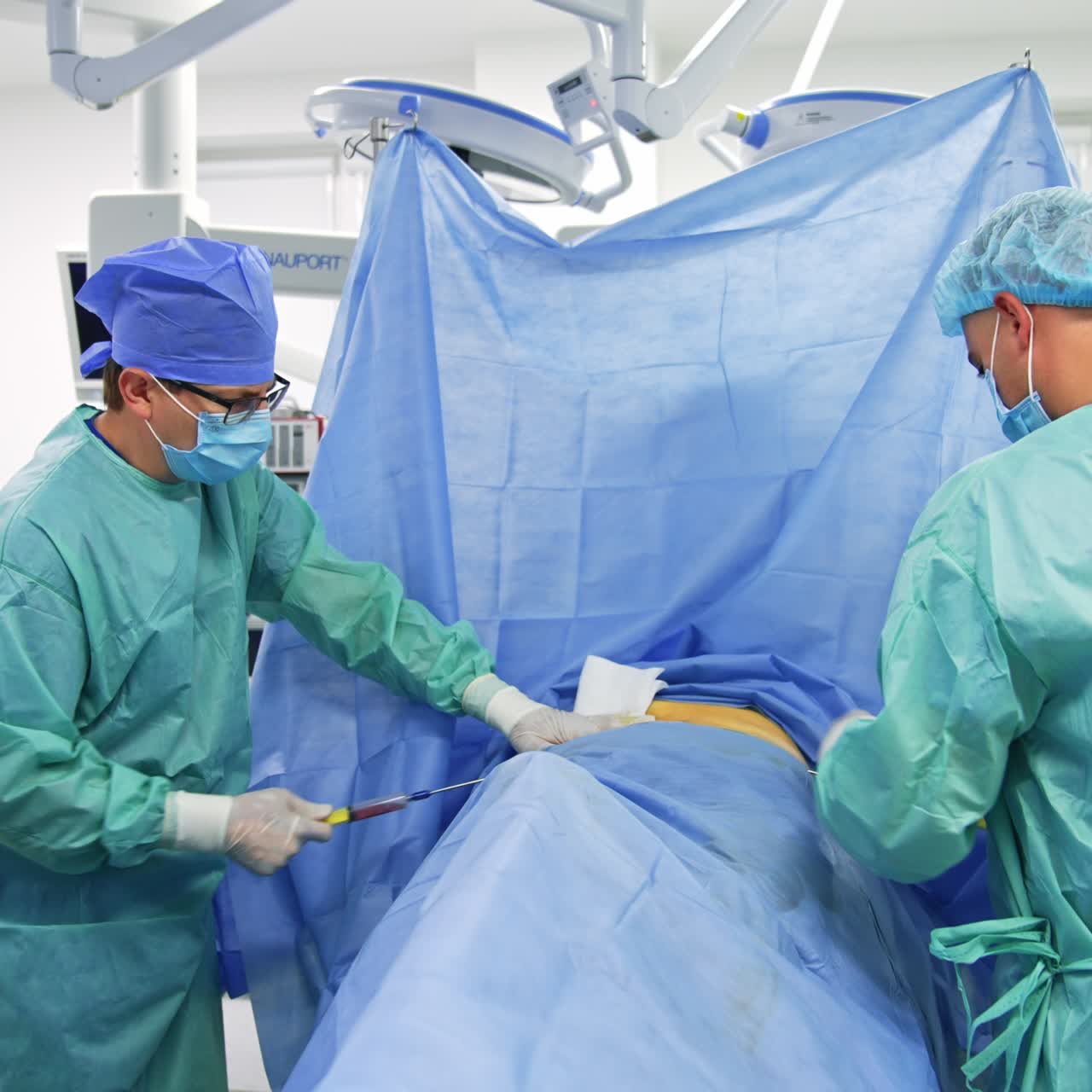 Pair of doctors collaborating at operation in surgery room. Surgery specialists showing big syringes into patient's belly on two sides. Female nurse assisting at surgery