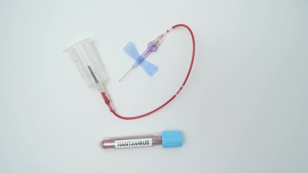 Blood being drawn into a hantavirus test tube using a butterfly needle isolated on a white background