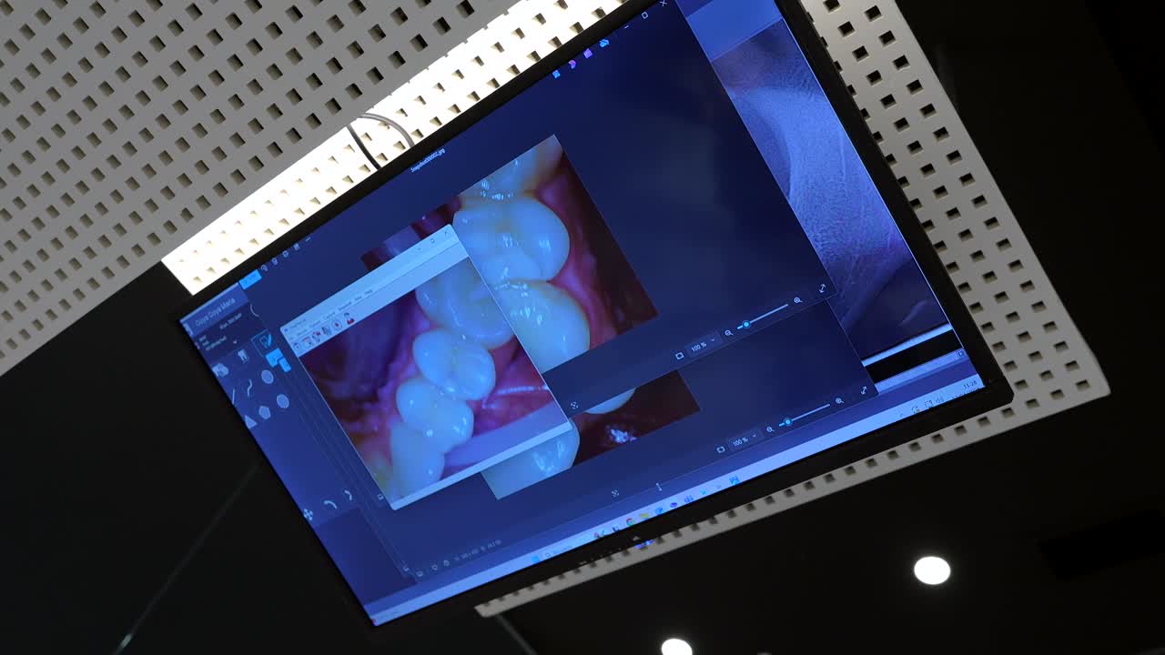 A monitor displaying dental medical images