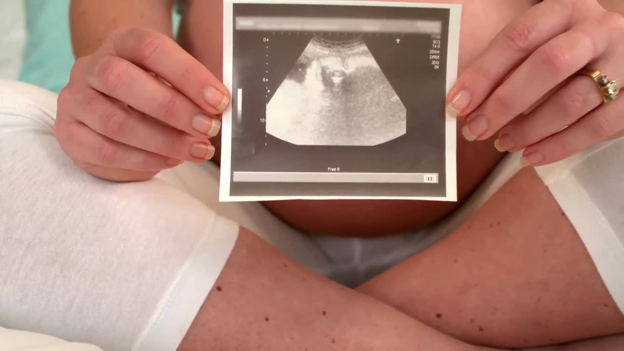 Donna incinta che mostra l'ecografia