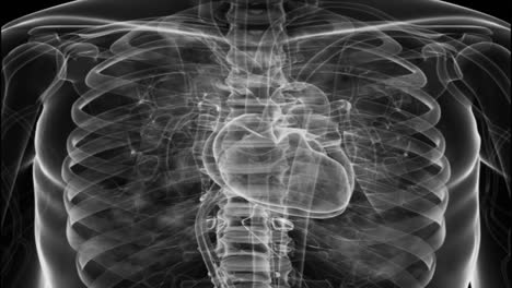 chest x-ray of bothlung and concept corona virus inrespiratory systemnervous system. stock video