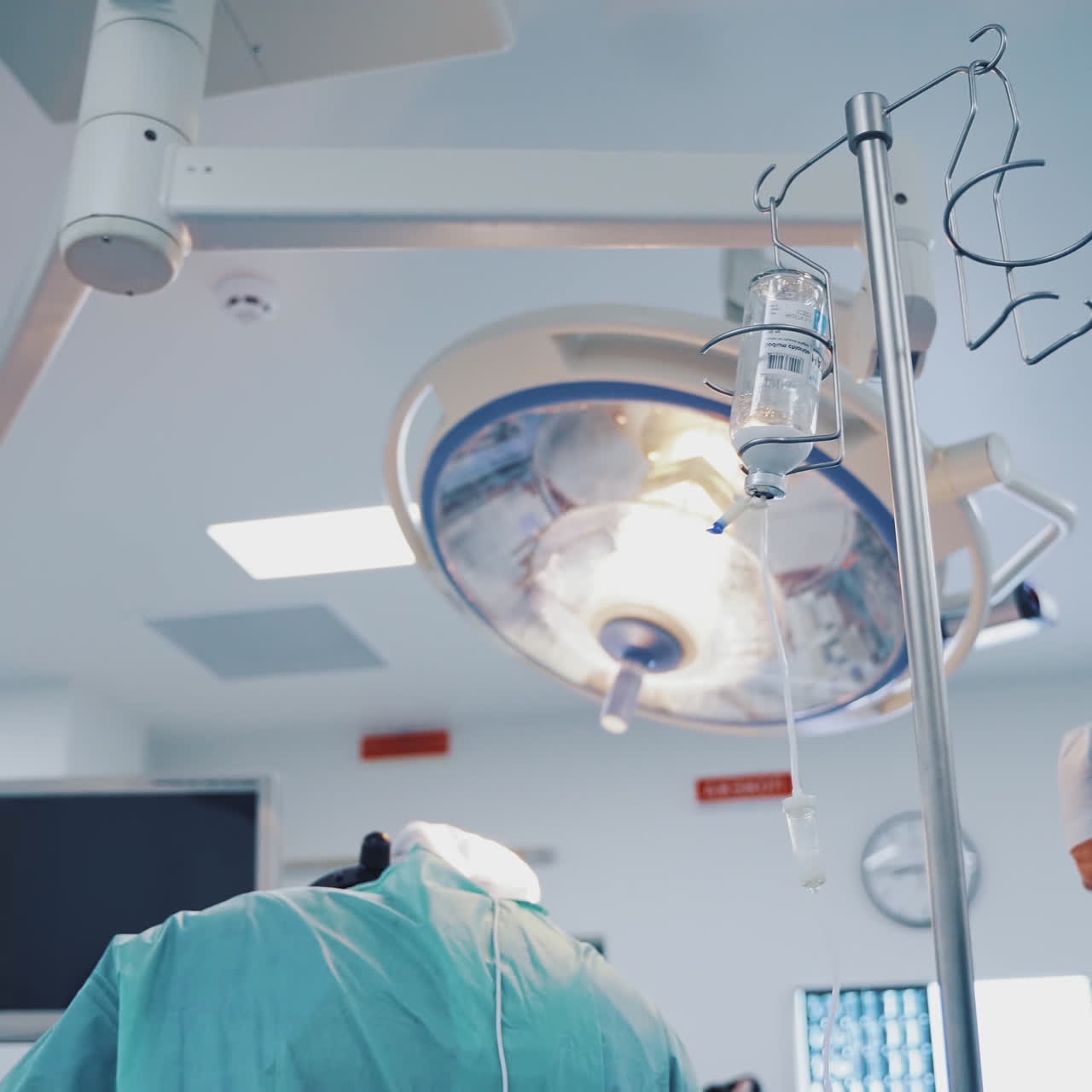 Tripod with drop counter for patient in operation room. Modern operating room with surgeons during the operation and a bottle with anasthesia liquid for patient.