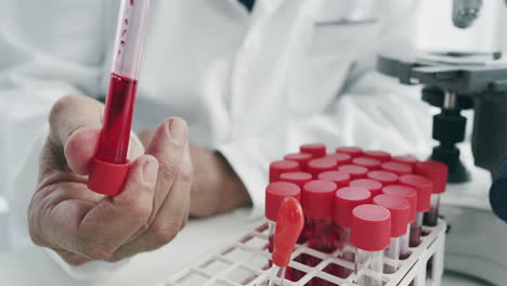 scientist performing blood tests in laboratory