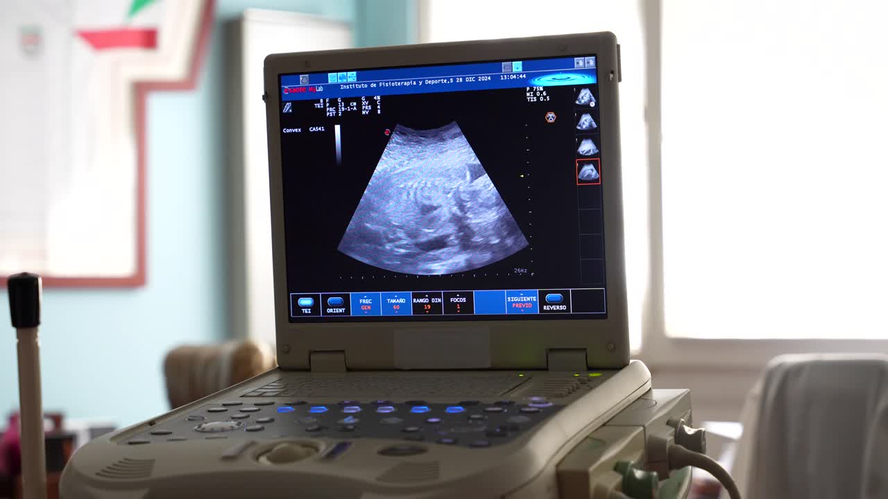 Primo piano di ecografo che mostra il battito cardiaco del bambino mentre il ginecologo controlla i livelli ematici, 4K