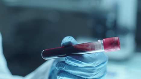 hand of doctor holding test tube with blood sample in laboratory