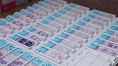 Test samples in medical laboratory. Test samples of blood putting on the special glasses. Medicine concept