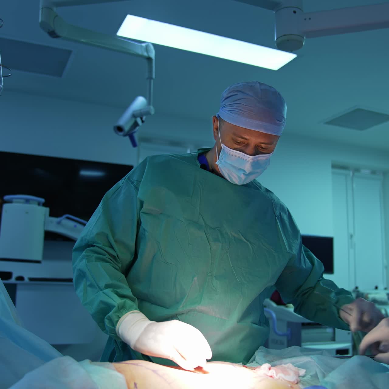 Filtration and pumping of fat for losing weight. Professional doctor uses medical instrument during liposuction. Surgeon performs cosmetic surgery