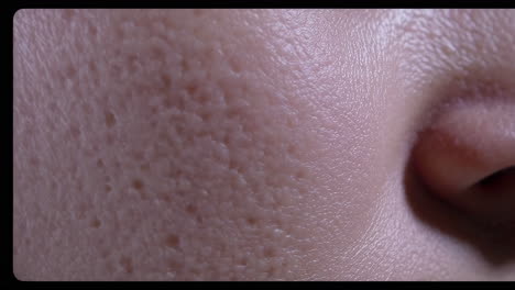 close-up of skin texture with pores and acne scars