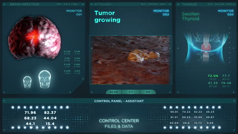 tumor growing medical hud