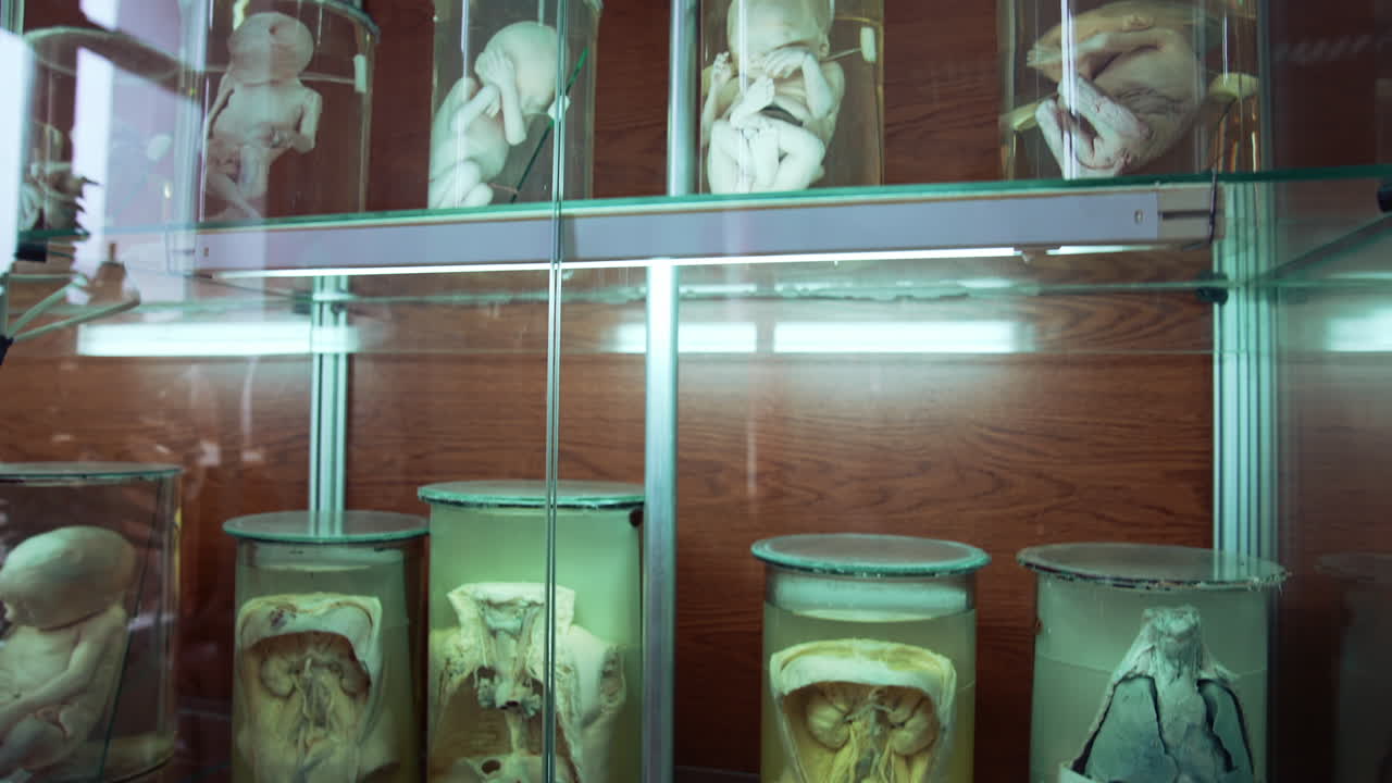 Human in formalin in medical museum. Collection of human organs preserved in large jars with formaldehyde and displayed vertically in museum