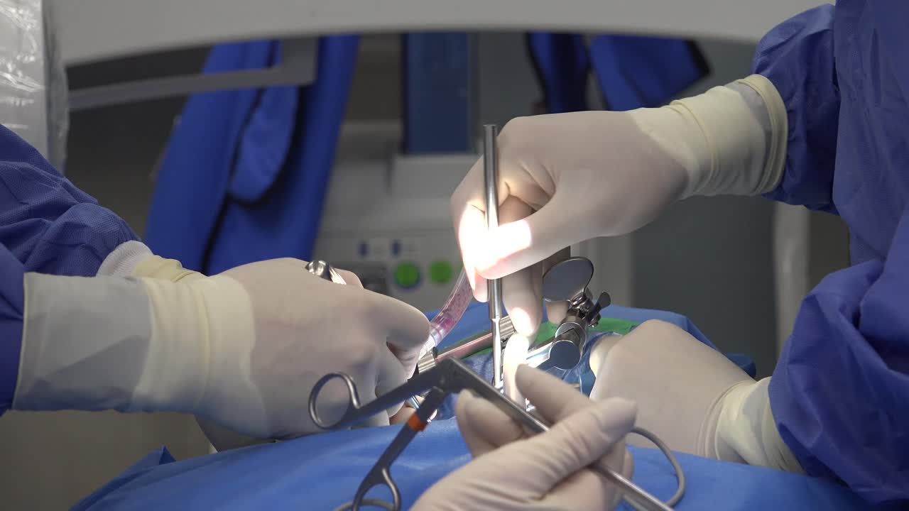 Spine Surgery Explained: Common Procedures, Recovery Expectations, Risks, and Advances in Minimally Invasive Techniques for Treating Chronic Back Pain and Spinal Disorders"