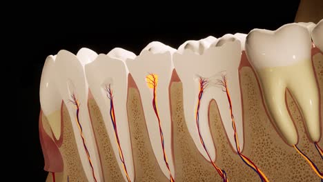 toothache. anatomical detailed section of the teeth. nerve inflammation. 3d animation