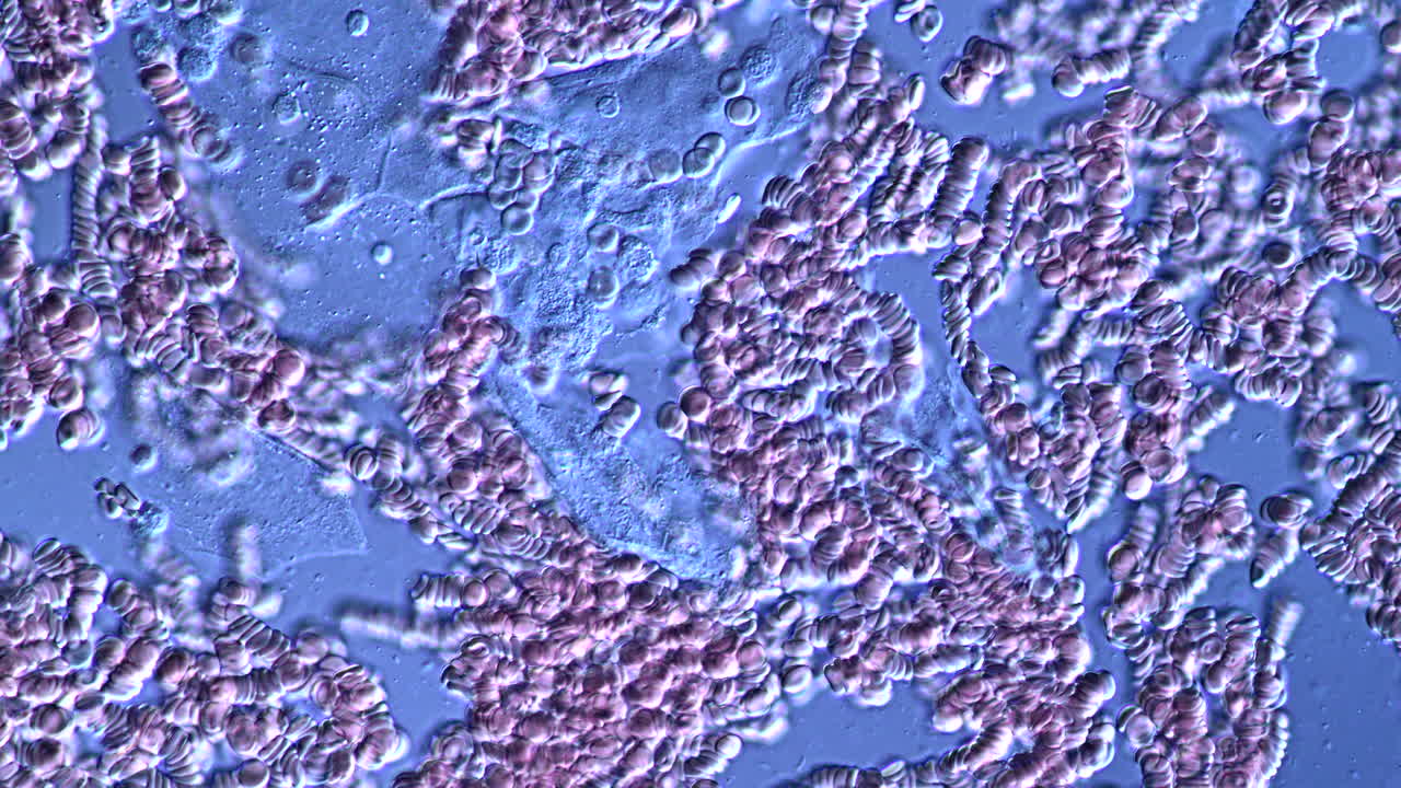 Microscopic view of blood cells forming rouleaux