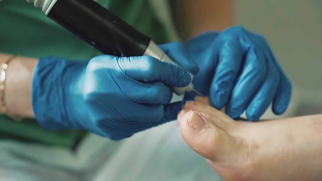 Tratamiento de piel y uñas mediante dispositivo para pedicura con torno