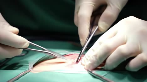 a close-up view of a surgical procedure highlights skilled hands using instruments to perform an operation. the setting is strictly sterile, emphasizing professionalism and care.