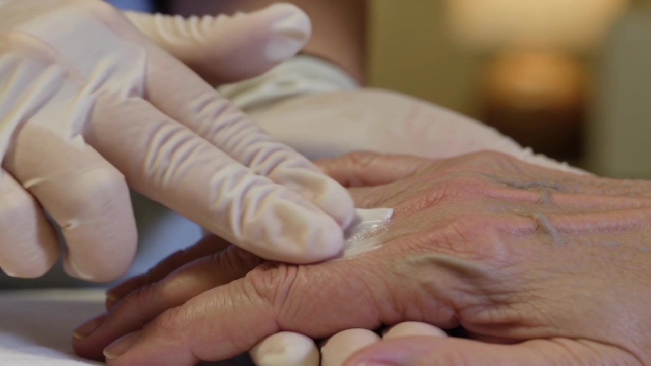 Ein Pfleger mit Handschuhen trägt nach einem Klecks Creme auf die rechte Hand eines Senioren am Bett auf und beruhigt dabei den Fingerknöchel.