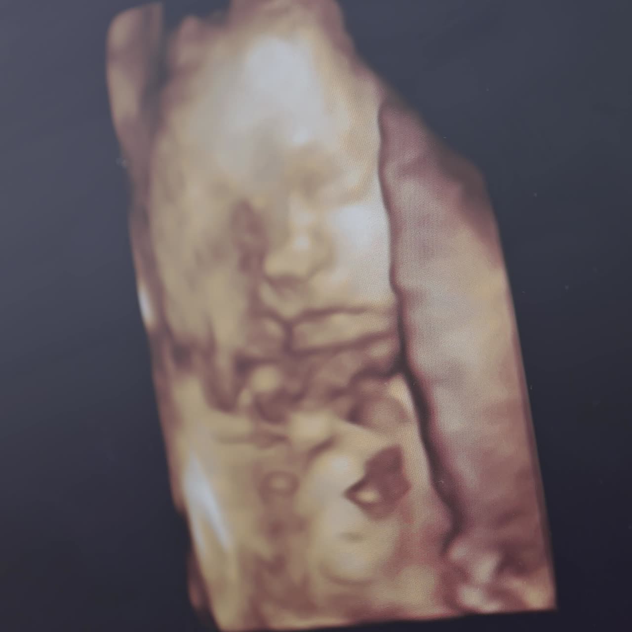 Embrione umano a colori sullo schermo durante l'ecografia. Ecografia di donna incinta. Analisi scientifica. Piccolo bambino nel grembo materno. Primo piano.