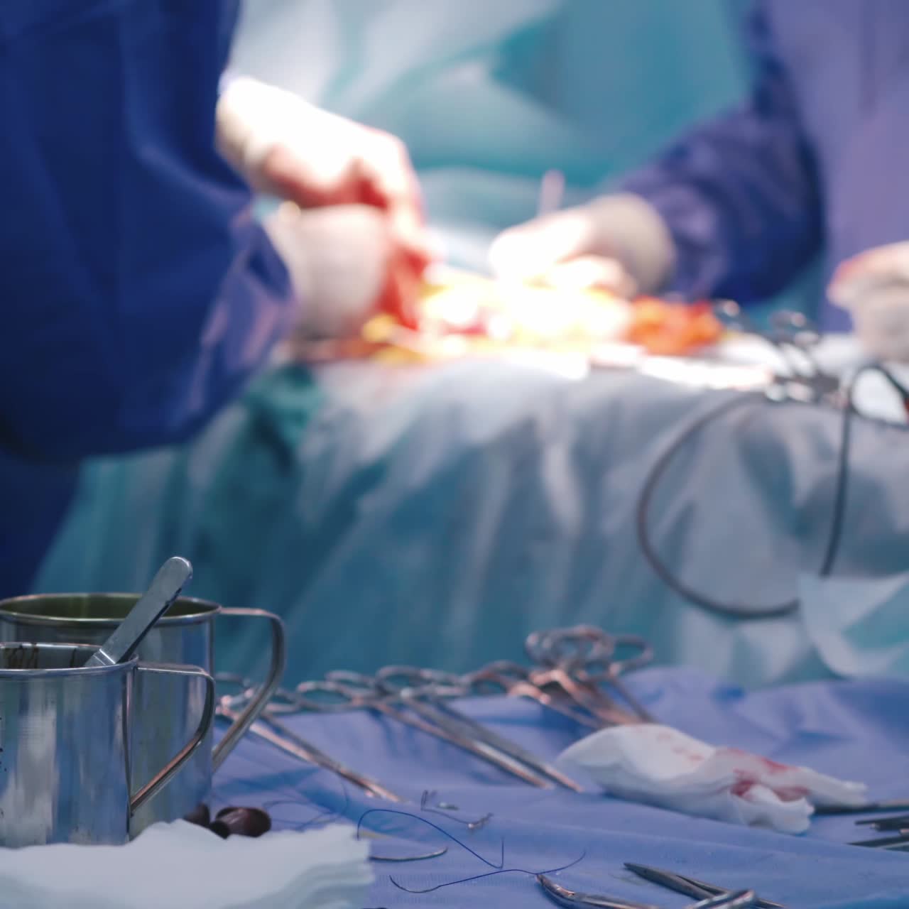 Surgery operation. Surgical treatment concept. Medical hands performing operation with surgery tools. Medical instruments on a table. Close-up.