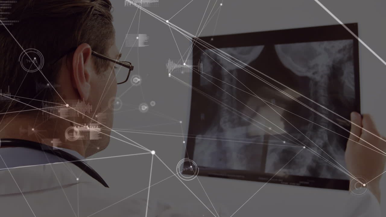 ⁇ 스레이로 백인 남성 의사에 대한 연결 네트워크의 애니메이션