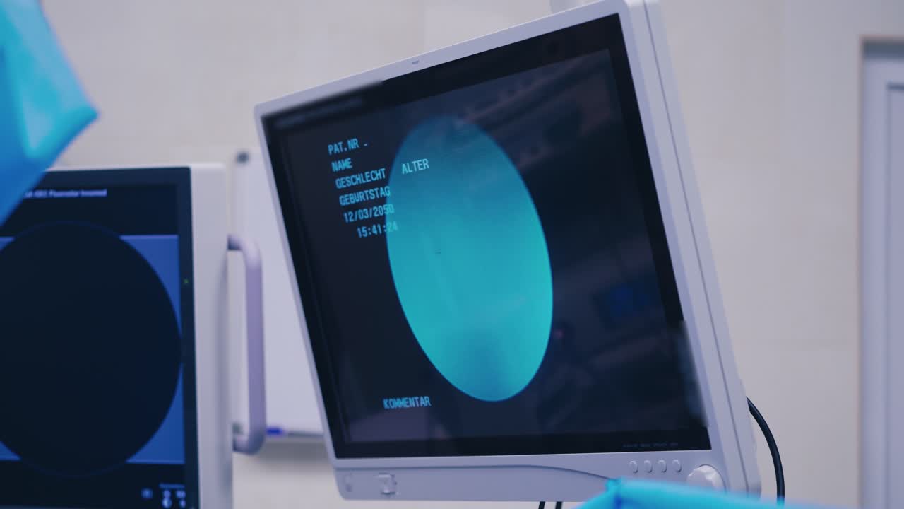 Modern equipment in the operating room. Endoscopic surgery on the screen. Display shows a laparoscopic operation.