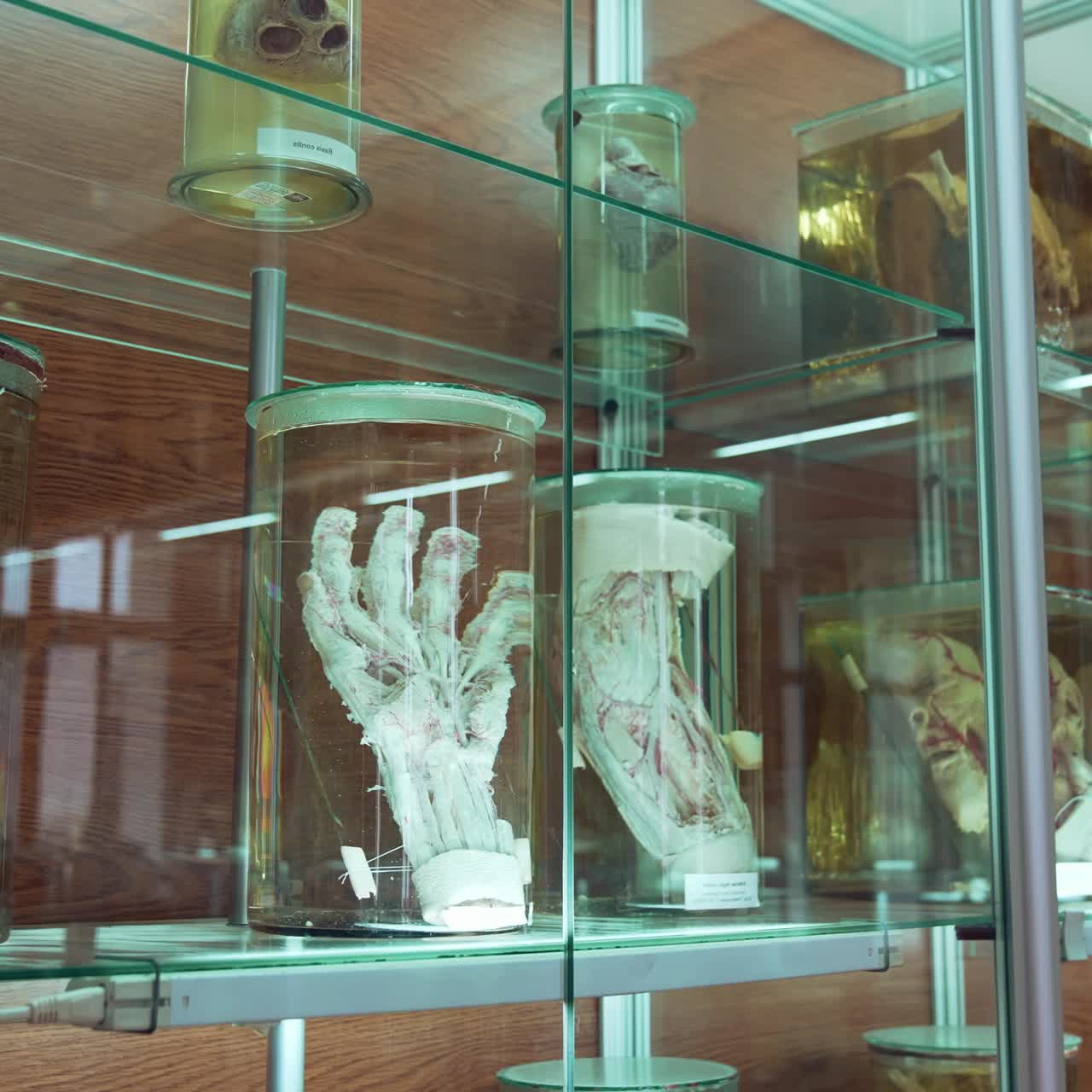 Human organs in museum. Human organs in formalin in anatomical museum