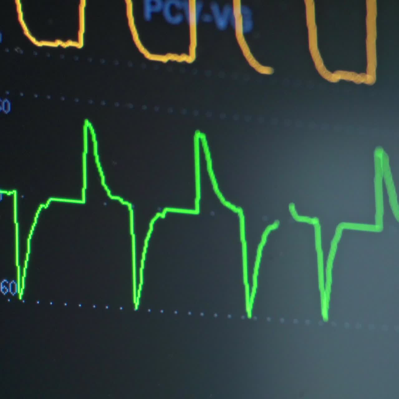 Monitoraggio della frequenza cardiaca