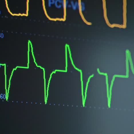 heart rate monitoring