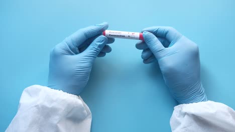 prueba de coronavirus de muestra de sangre