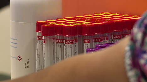 procedimiento de extracción de sangre