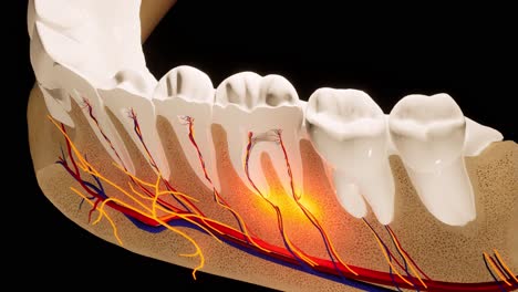 dolor de dientes. sección anatómica detallada de los dientes. inflamación del nervio. animación en 3d