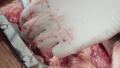 surgeon hand operates patient heart. chest cavity opened with rib spreaders for access to pulsating organ for effective grafting harvested vessels closeup