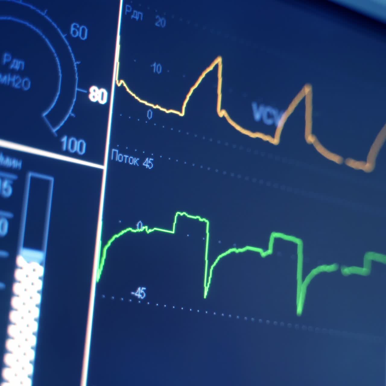 Monitoring vital signs of the patient as heart rate. Digital heart monitor read out with lines graphing and numbers displayed of patient being measured. Close-up