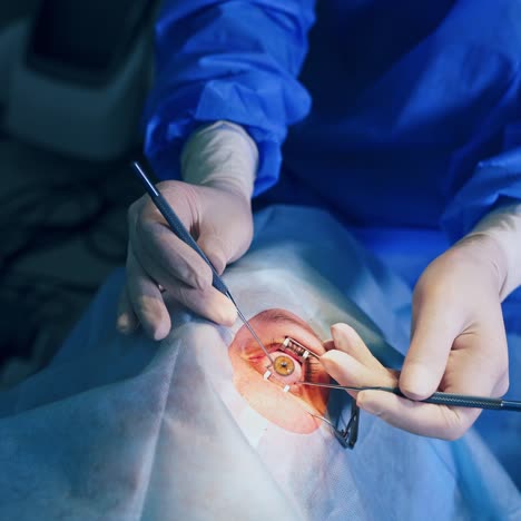 ophthalmology surgery for eyes