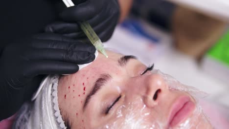 young woman is lying on the couch while professional cosmetologist in gloves is making multiple injections in woman's forehead